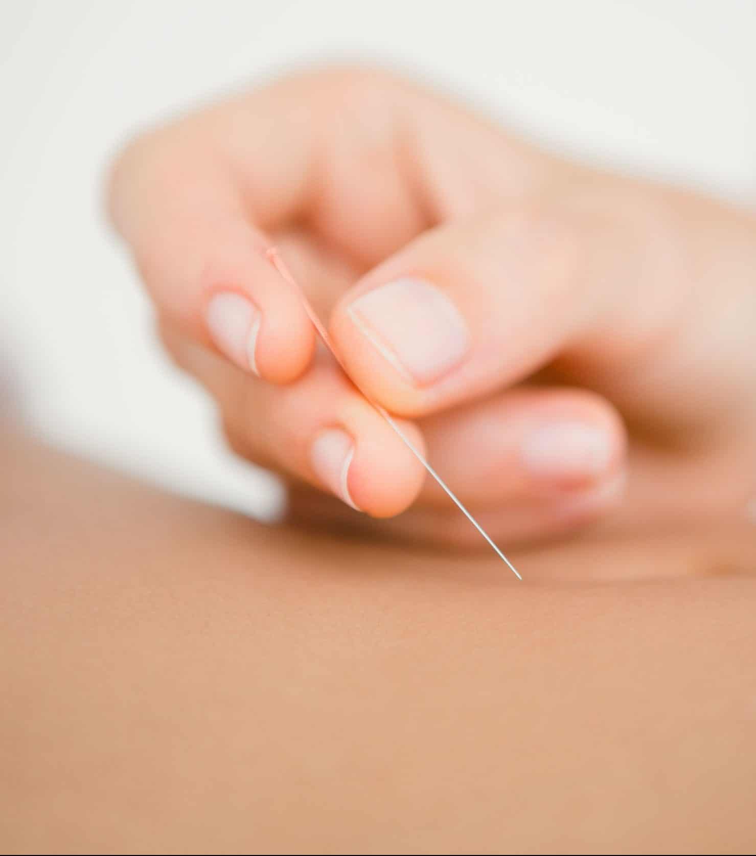 Maplebrook Acupuncture | Individual Acupuncture